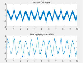 ECG Noise Reduction Result